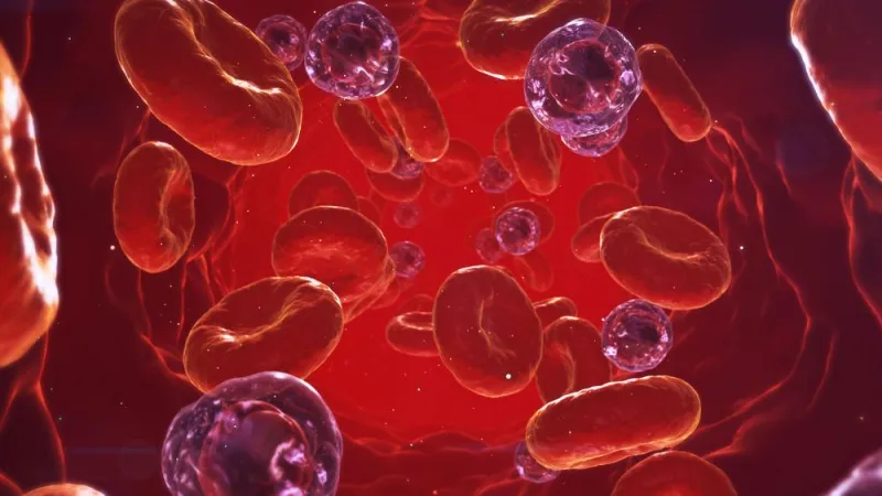 New approach cuts sepsis diagnosis from days to hours, researchers report