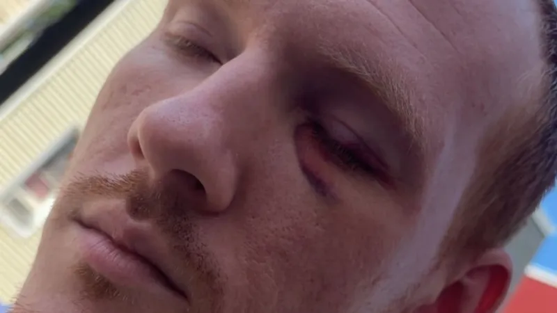 Assault charge dropped for man who said York police used excessive force in his arrest