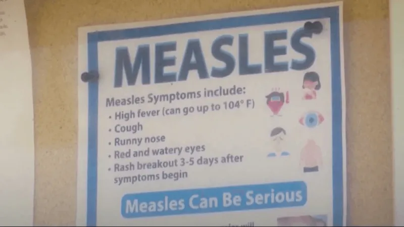 Doctors speak on importance of measles vaccine