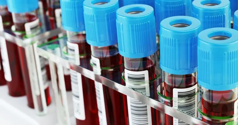 Fasting before blood tests might not be necessary, new research shows