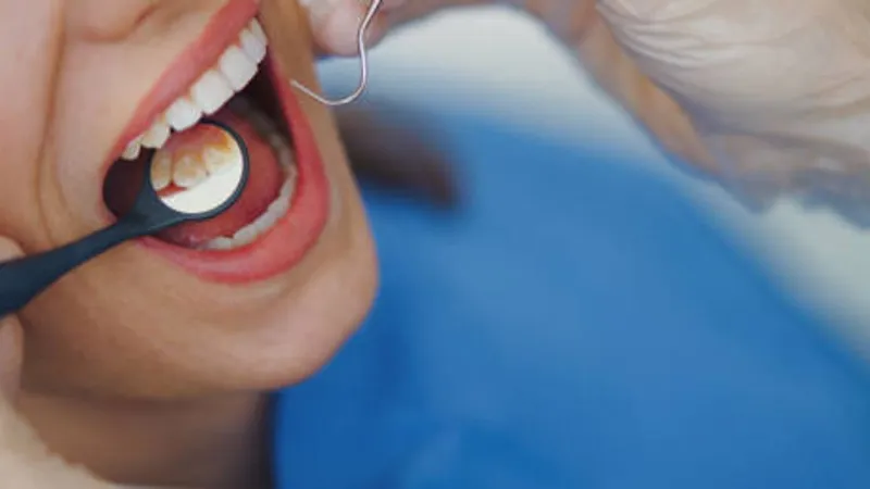 'Free Dental Day' for uninsured adults returns in 2026