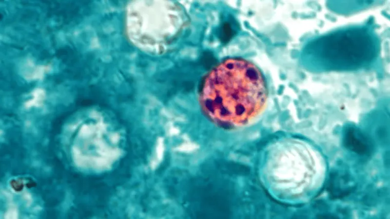 Parasitic infection cases causing watery diarrhea top 200 in North Carolina