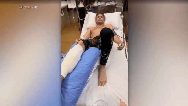 MORNING BUZZ: Diver expected to make full recovery after shark attack