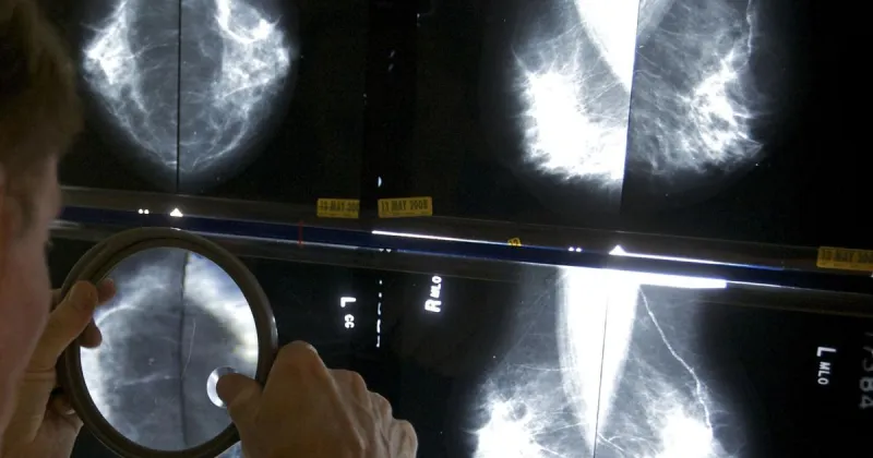 Local oncologist urges women not to wait when it comes to breast cancer screening