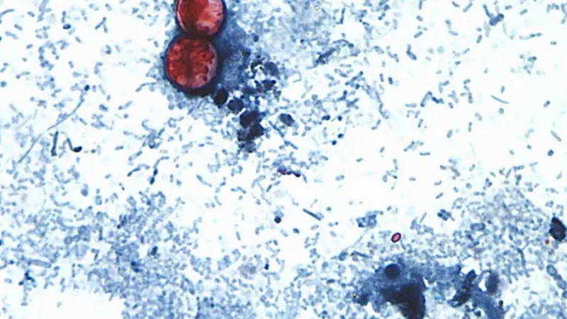 King County on alert as CDC links parasite outbreak to Taco Bell lettuce