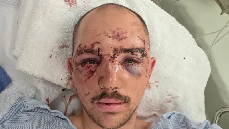 Walla Walla man faces more surgeries after surviving Alaska bear mauling