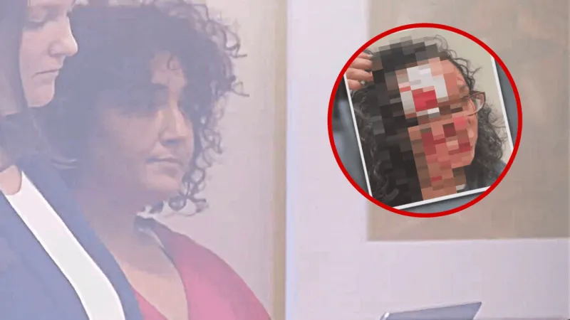 Seattle woman accused of biting off victim's forehead to undergo mental health evaluation