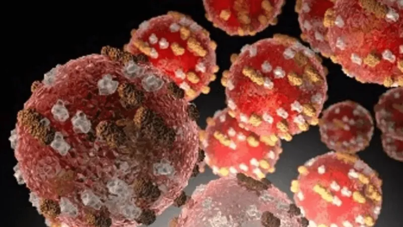 Health officials confirm measles case in Pike County, Ohio